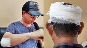 Tragedi Iduladha di Muara Muntai Ilir: Kades Dihajar, Polisi Diam, Pelaku Bebas Berkeliaran 3 download